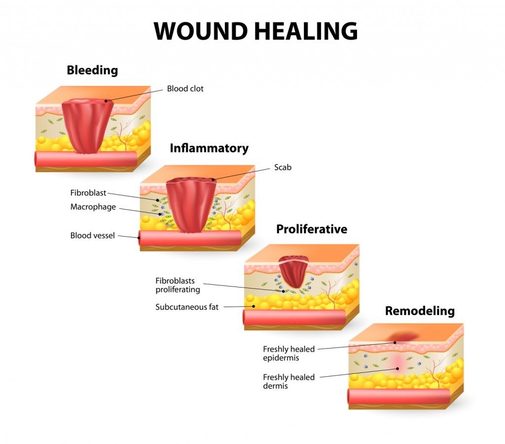 درمان زخم با ساختار شبیه پوست انسان